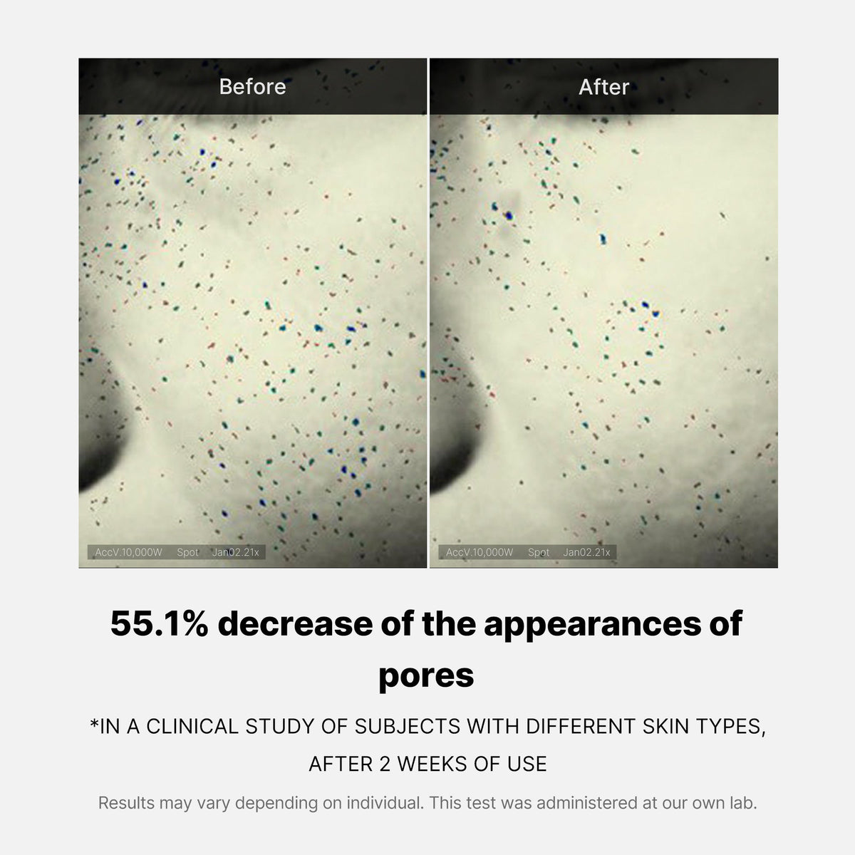 pore-care-duo-g9 05_12ddab8a-64be-4612-8ee1-27e5ec701921.jpg