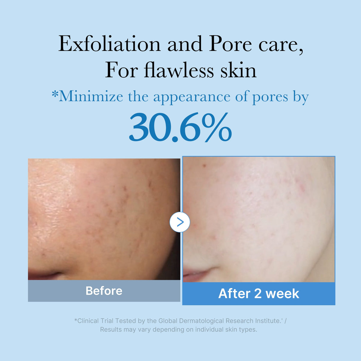 zero-pore-toner-e2 01_d6480b4e-3c08-4954-994a-ed5212c1839c.jpg