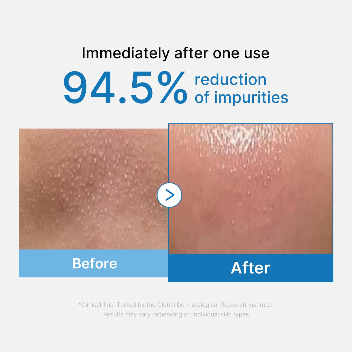 zero-pore-blackhead-deep-cleansing-oil-l6 01_eed557ec-5857-46a2-8b17-dbd67c692dcb.jpg
