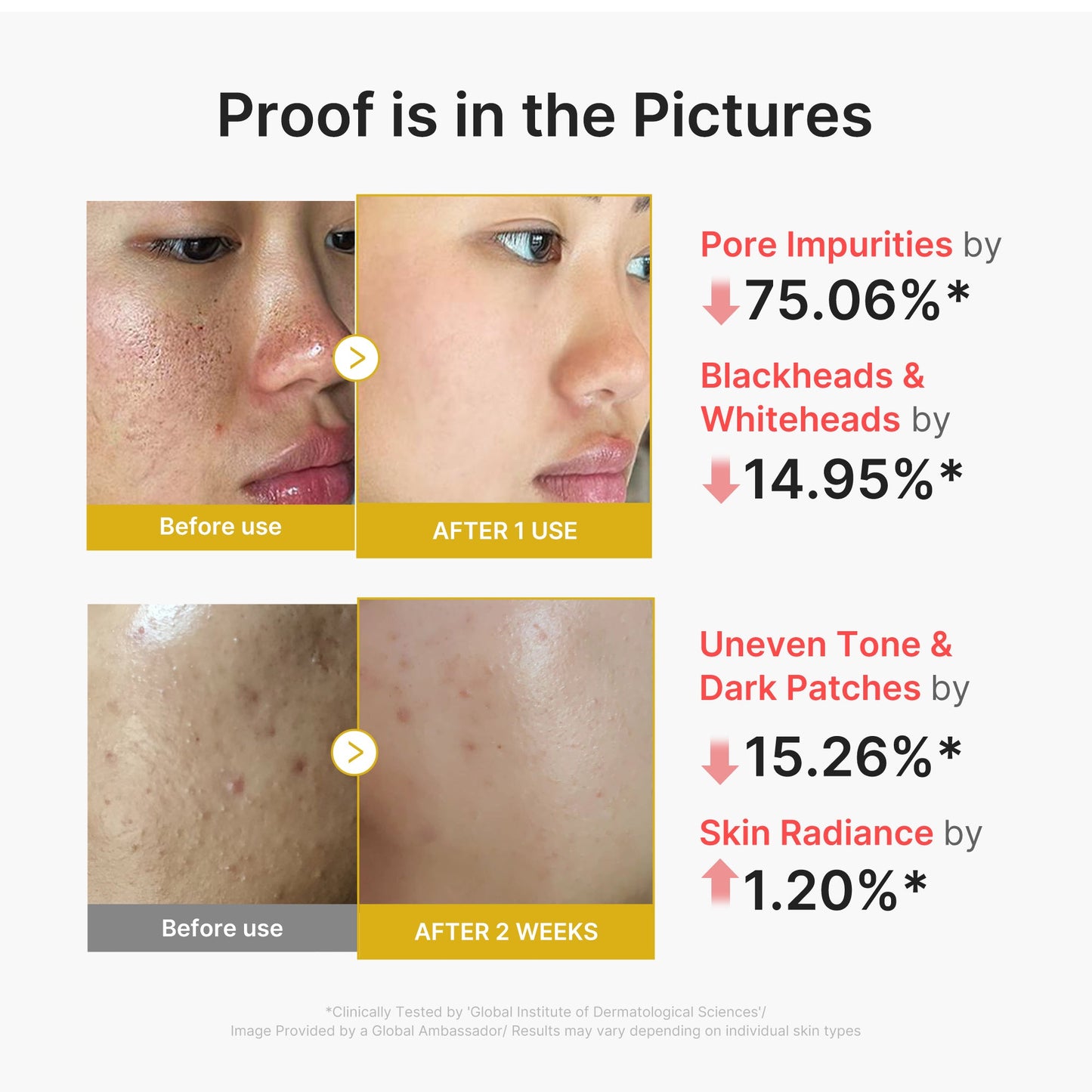 kojic-acid-turmeric-peel-shot-n4 02_45fe66d3-b3f6-4100-aa52-2afd7eded417.jpg