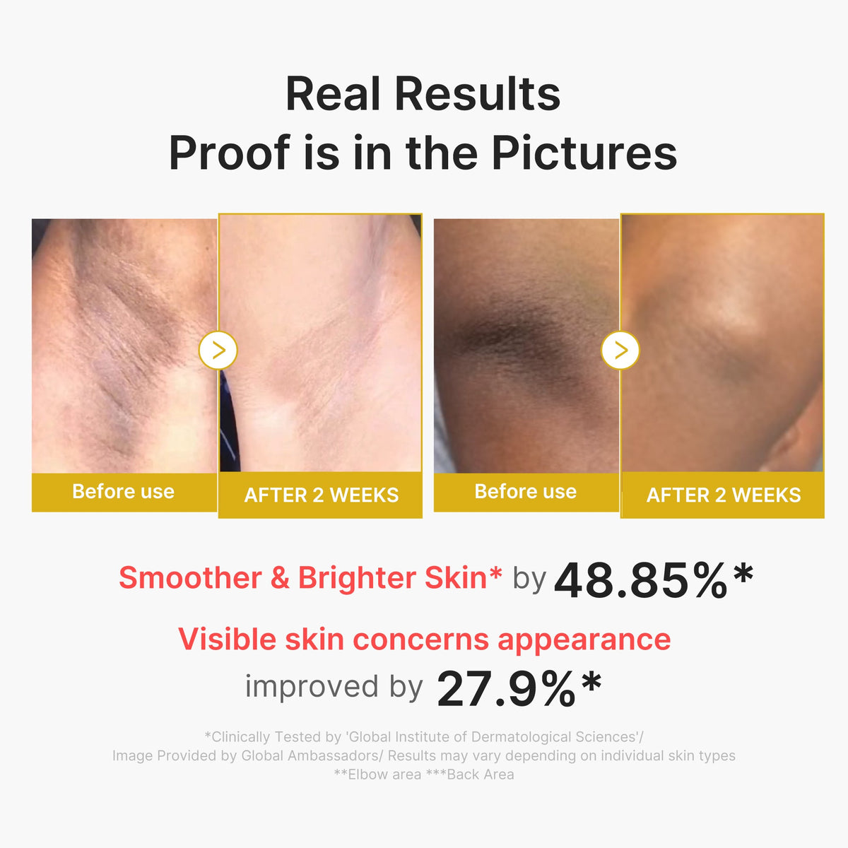 kojic-acid-turmeric-body-peel-shot-e5 02_72880cfc-382b-440b-8152-7e3dce87da2a.jpg