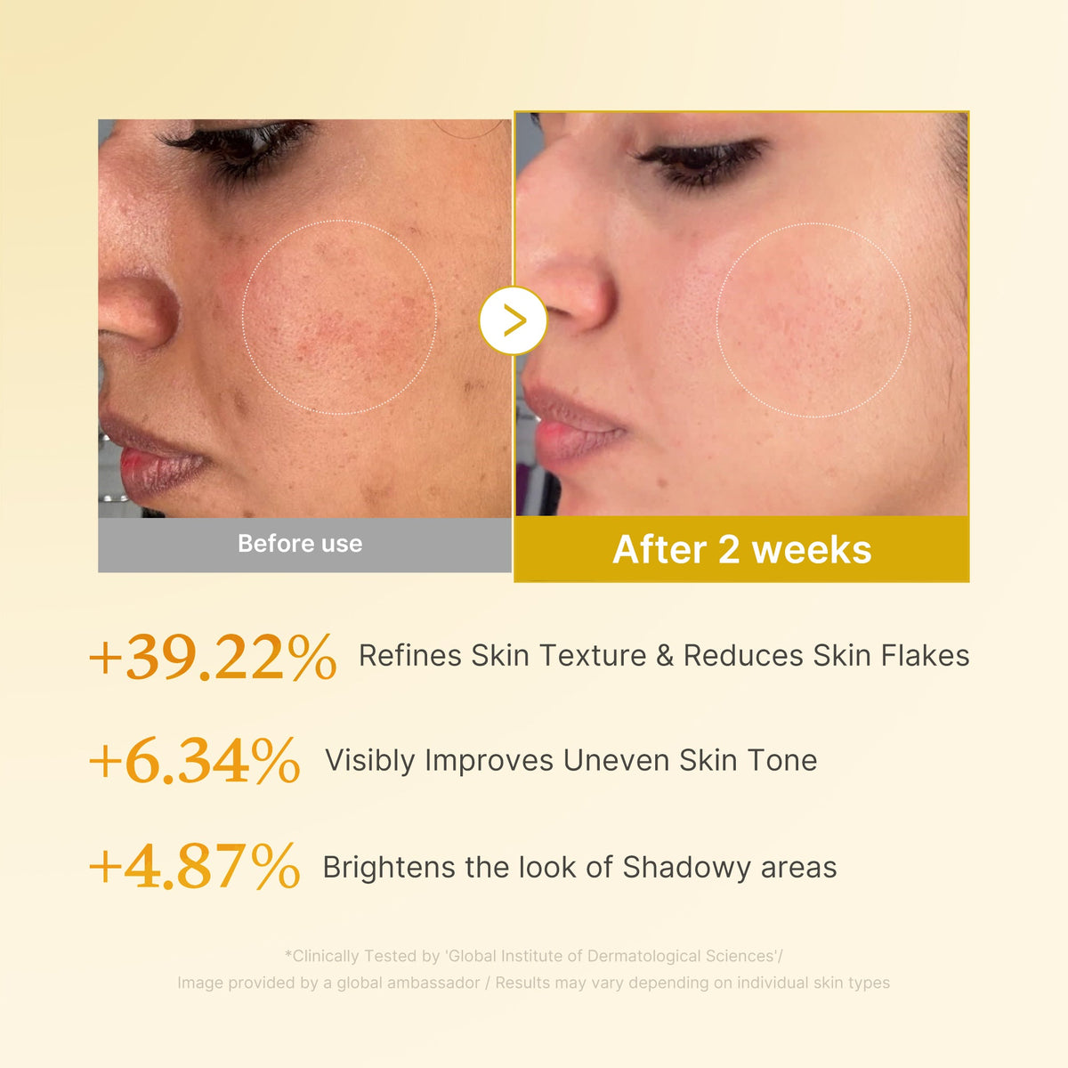 kojic-acid-turmeric-toner-e5 03_b7578d52-4c93-4407-9c6c-7cb230c85b06.jpg