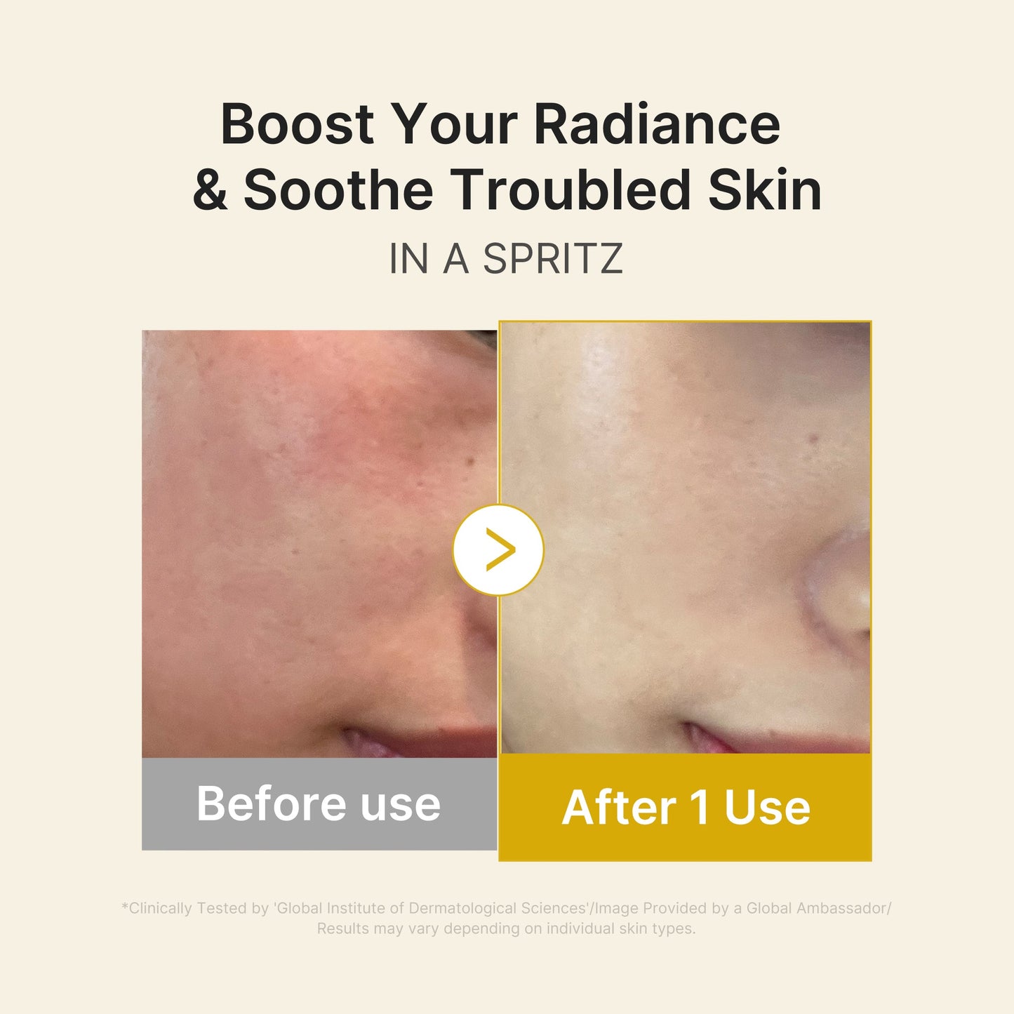 kojic-acid-turmeric-vitamin-gold-jelly-mist-serum-z7 03_dc9cd19e-4e57-49d3-9b66-c7762e8a63f1.jpg