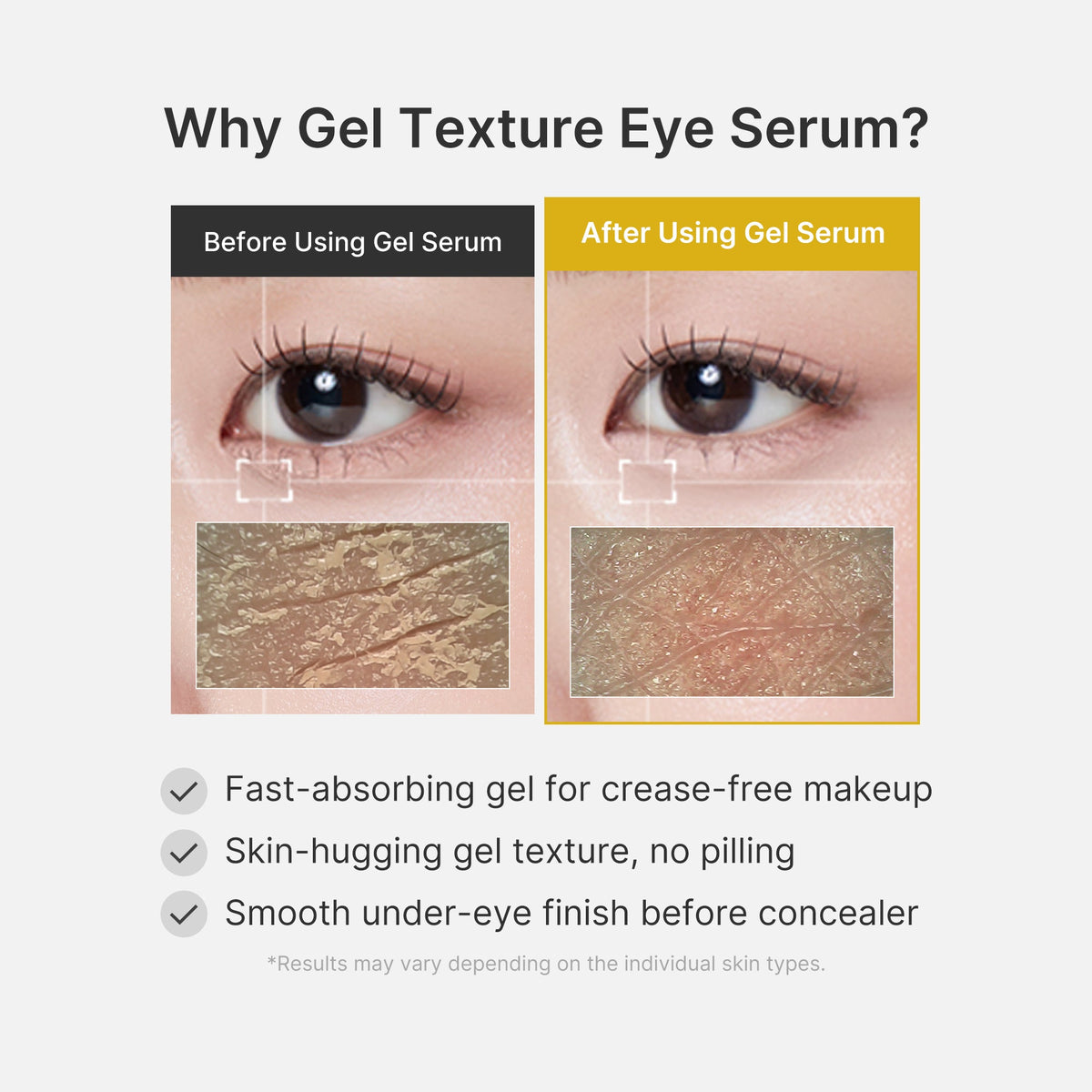 kojic-acid-tumeric-eye-gel-serum-a2 04_0487ef36-49f4-4294-8049-bb55118b05fe.jpg