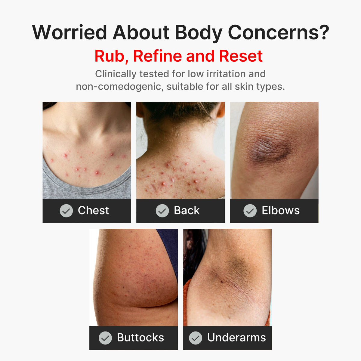 kojic-acid-turmeric-body-peel-shot-e5 04_8a7237f2-3ebf-401e-bd85-54841aeb3efc.jpg
