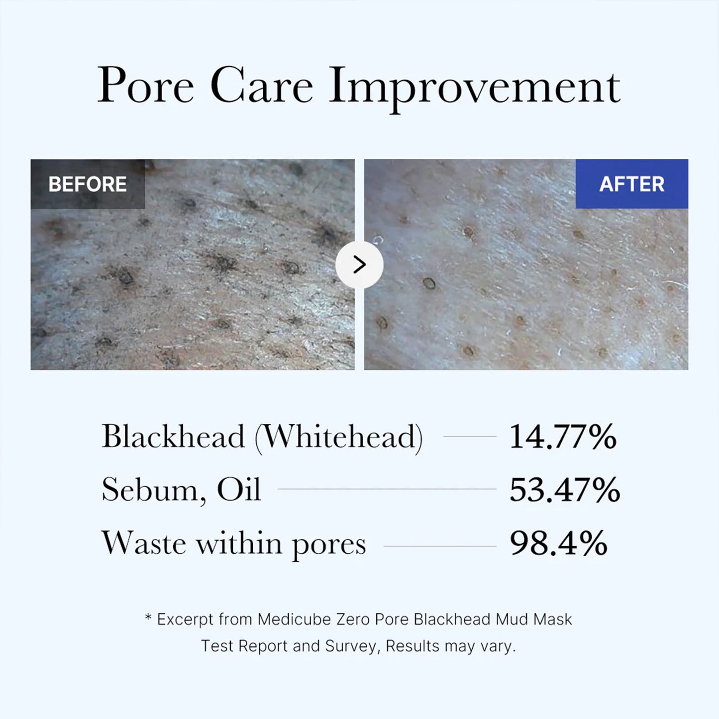 zero-pore-blackhead-mud-mask-n5 05_9362a158-c2b3-4525-acc0-631a2cfdea47.jpg