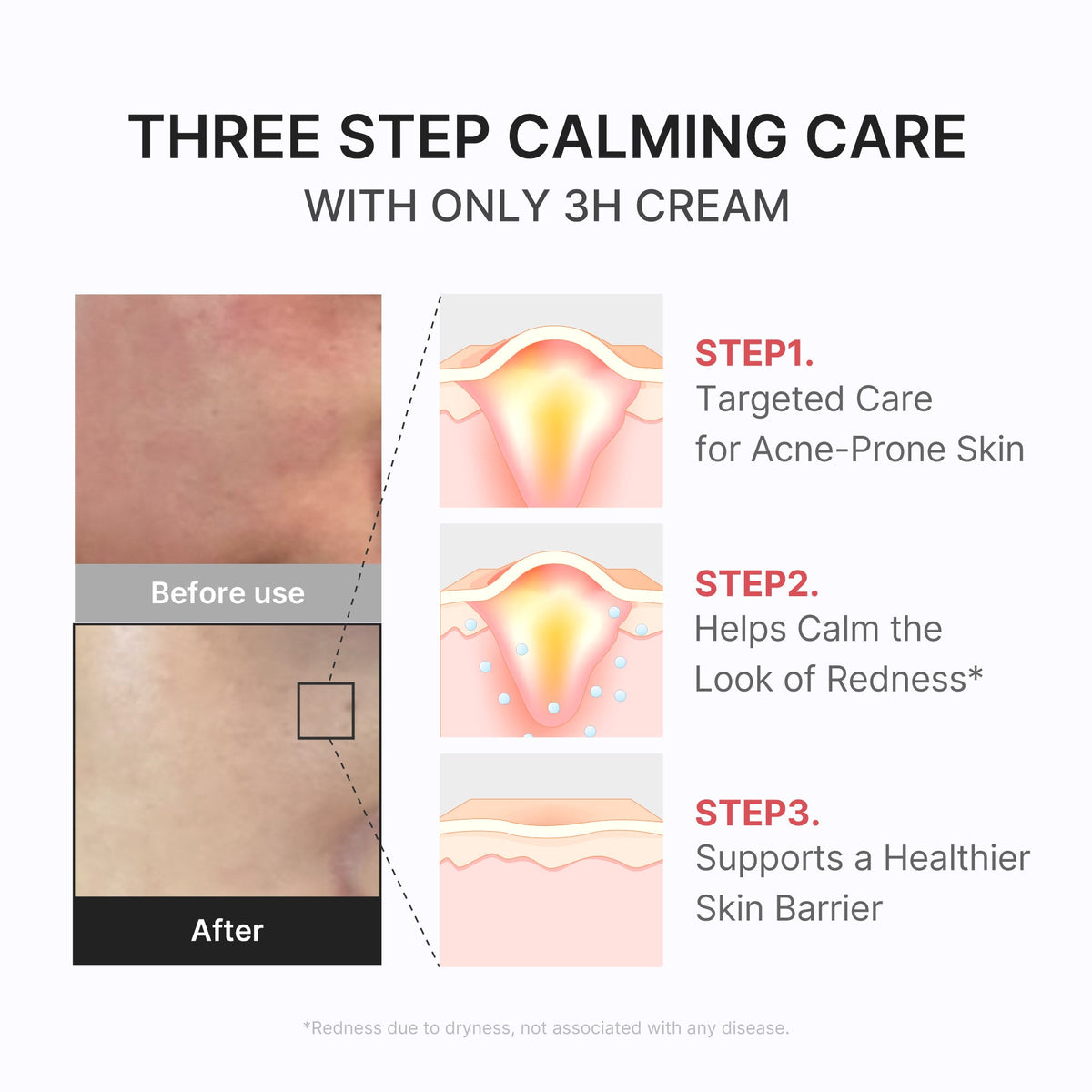 3h-daily-relief-cream-t5 3H_04.jpg