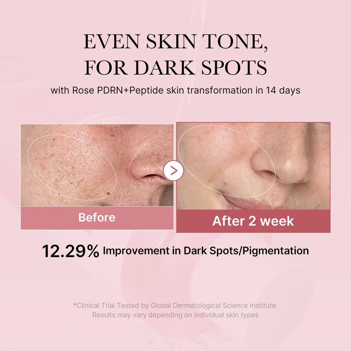 pdrn-pink-peptide-toner-n3 PDRN_01_308c518e-5ac6-4e54-99bd-eabc8796739b.jpg