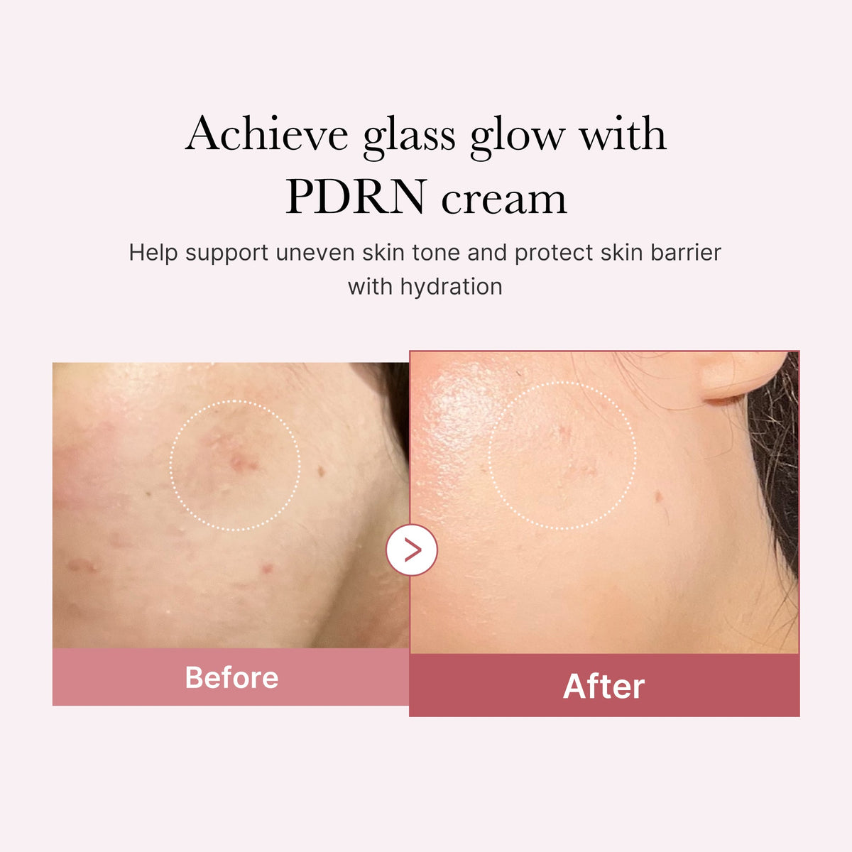 pdrn-pink-peptide-cream-s7 PDRN_02_d7805bfe-cf43-446a-b71b-a276683f136b.jpg