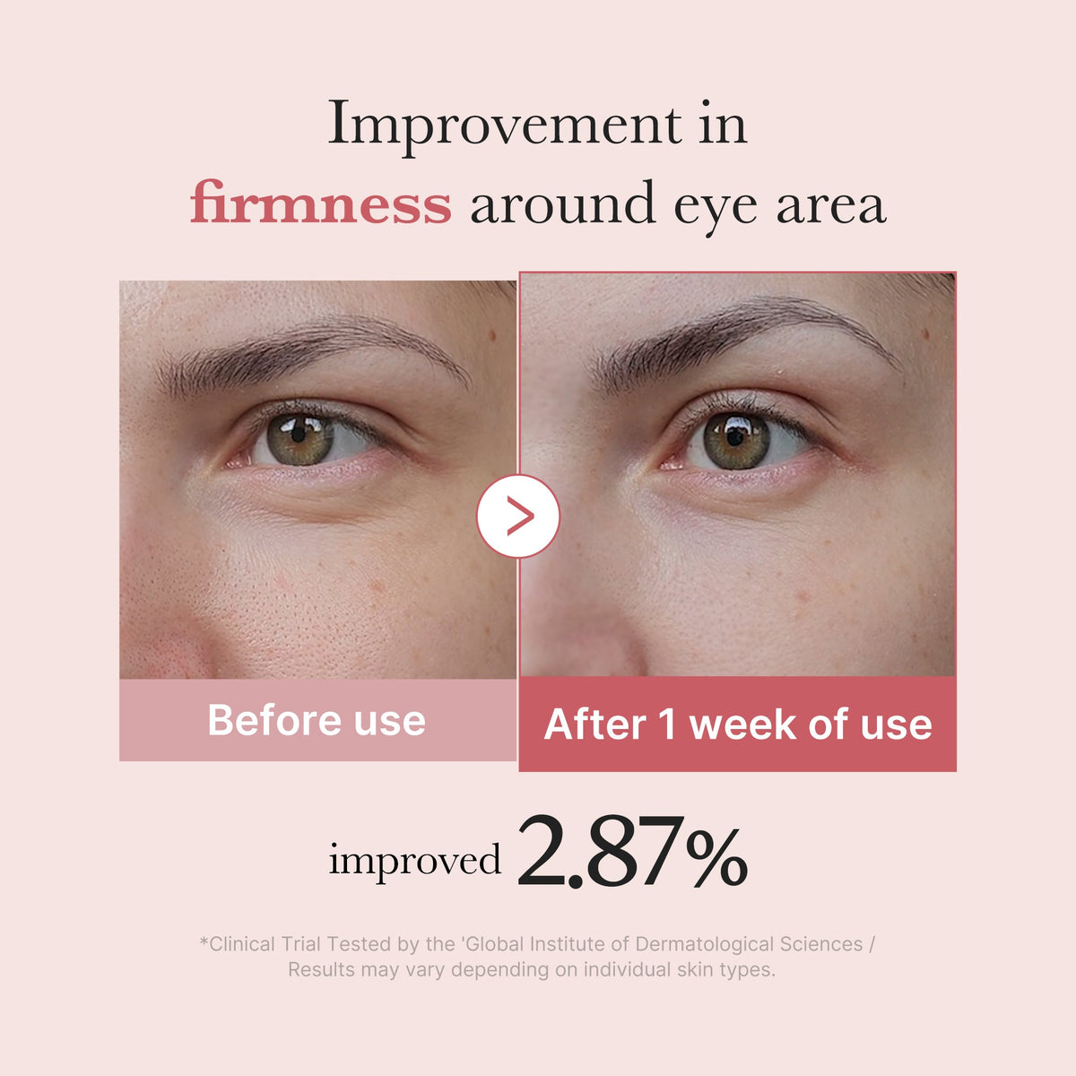 pdrn-pink-peptide-eye-cream-y1 PDRN_03_256dd753-0a2f-41b4-b3cd-bbfd3bc27018.jpg