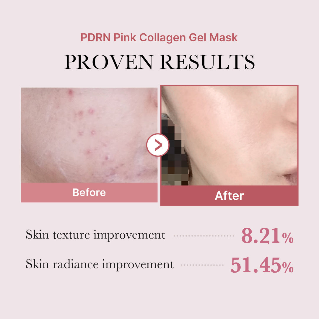 salmon-pdrn-pink-collagen-jelly-gel-mask-y9 PDRN_12.jpg